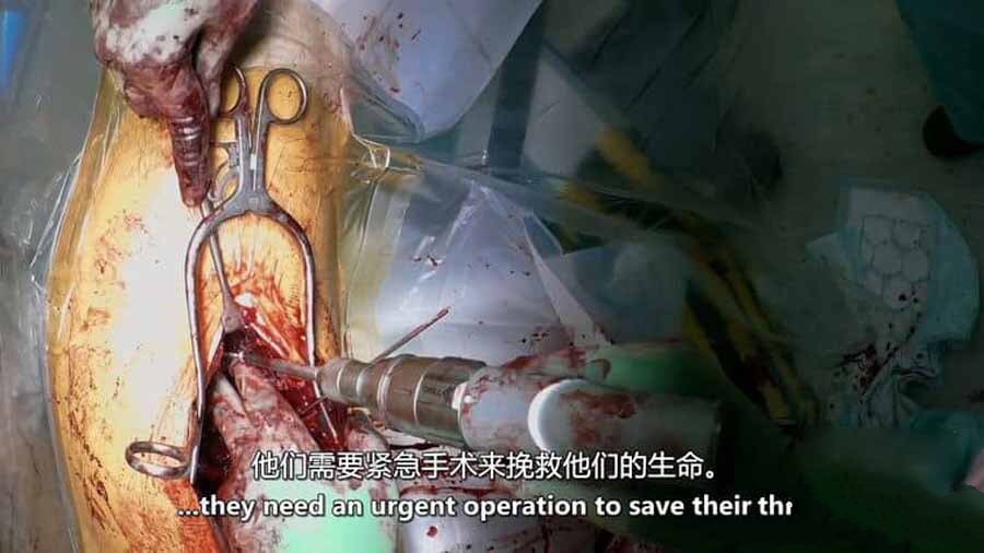 纪录片《外科医生：生命边缘 Surgeons: At the Edge of Life 2023》[1080P/MKV][第5季全6集 英语中英双字 官方纯净版][8.64G][百度网盘]