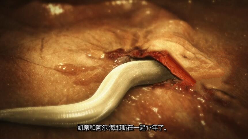 纪录片《体内的怪物/病魔缠身》[1080P][第八季共12集 英语中字][百度网盘]