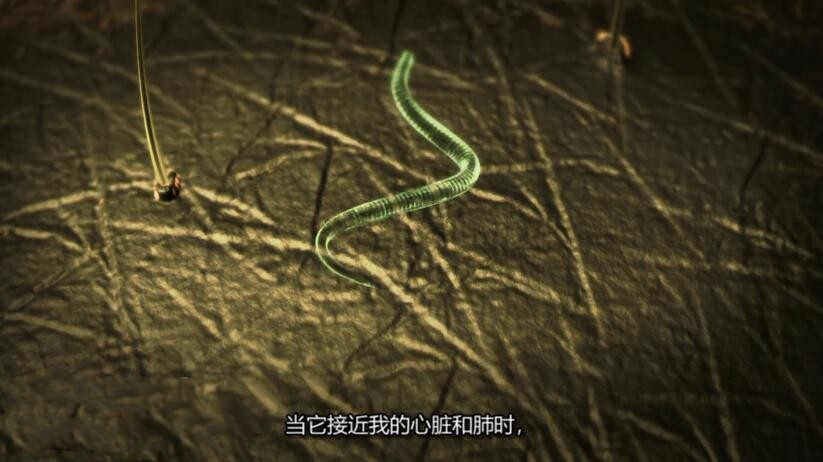 纪录片《体内的怪物/病魔缠身》[1080P][第二季共10集 英语中字][百度网盘]